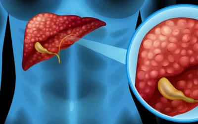 Understanding Liver and Gallbladder Cleansing