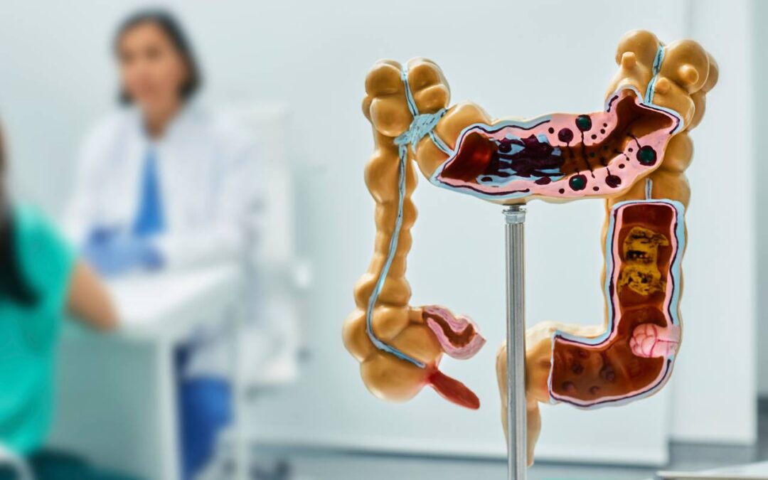 Diagnosis and Common Treatments for IBD