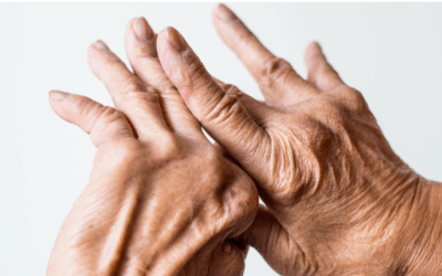 Arthritis – Causes, Symptoms and Therapy