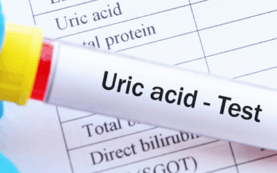 Lower Uric Acid with Natural Measures